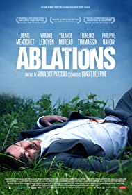 Ablations